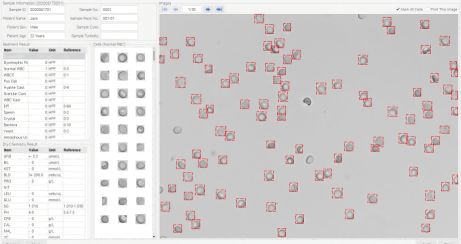 Urinalysis Hybrid Analyzer Results نتائج تحليل البول الهجين
