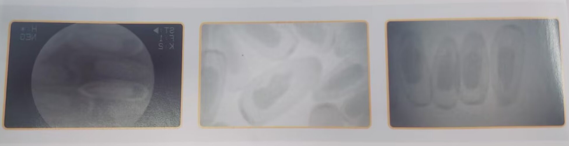 الأشعة السينية للبذور
