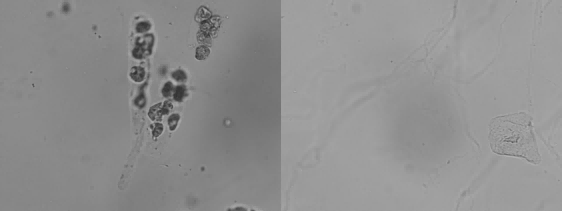 Urinalysis Hybrid Analyzer Results-1 نتائج محلل تحليل البول الهجين-1